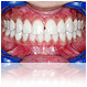 implante dentare