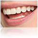 implante dentare